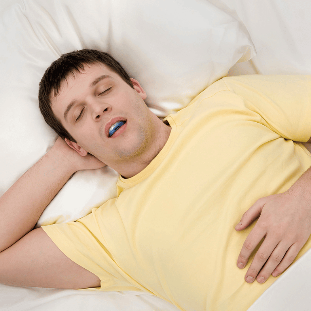 Everest Blue™ - Adjustable Anti-Snoring Mouthpiece
